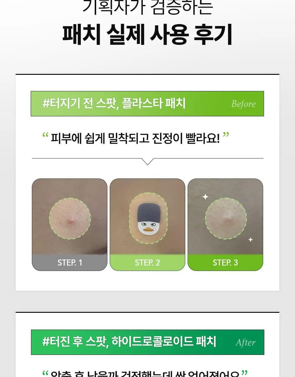 [라이즈 PICK] 유이크 바이옴 레미디 카밍 스팟 패치 2종 택 1 (단품/기획) 상세페이지 10